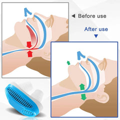 Anti snoring nose vents placed on a bedside table