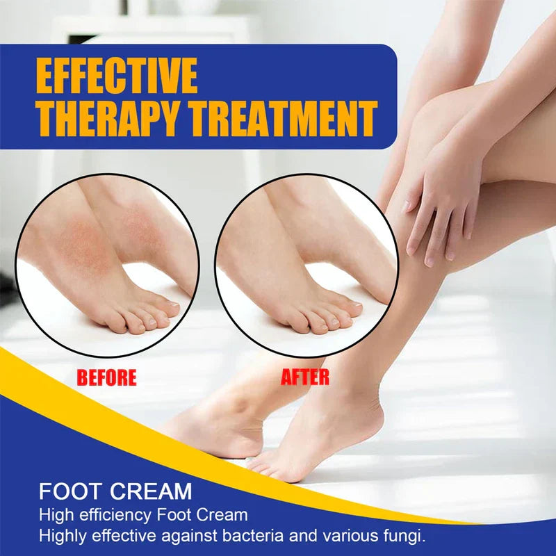 Athlete's Foot Ointment - Foot cream before-after graphic showing feet with ankle redness, then clear ankles, plus seated legs and product description text