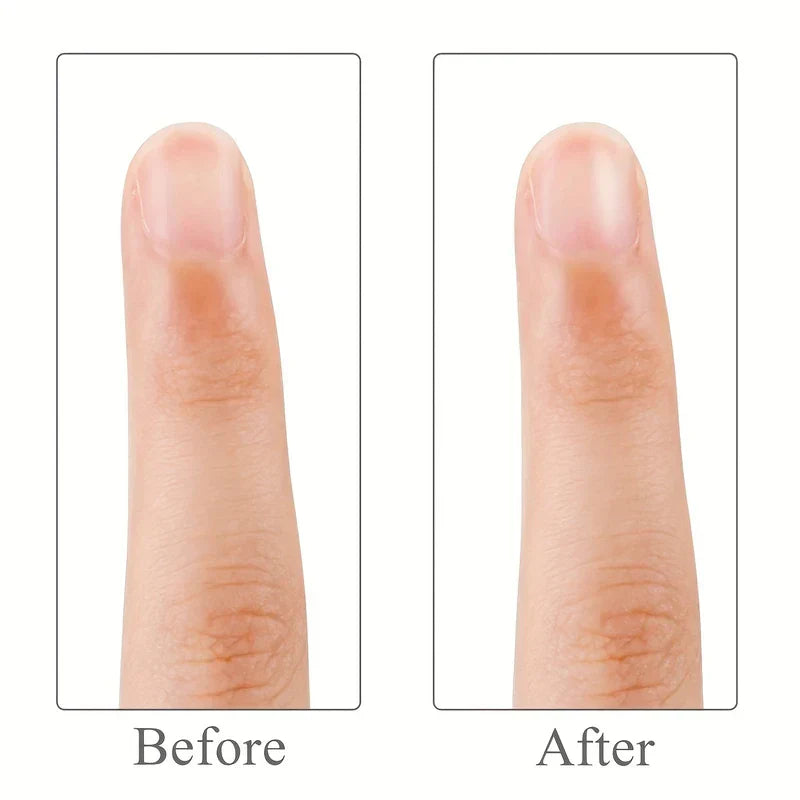 Electric Nail Buffer - Side-by-side close-up of a single finger nail, labeled Before on the left and After on the right, showing a smoother nail surface after