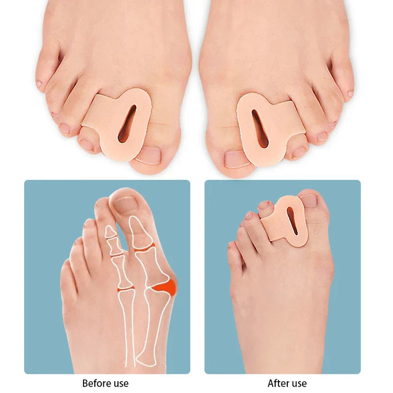 Big Toe Bunion Arch Support Pad