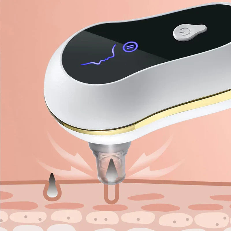 Pore Cleaner Tool - Close-up of a white and gold device nozzle above a diagram of skin layers, with suction arrows