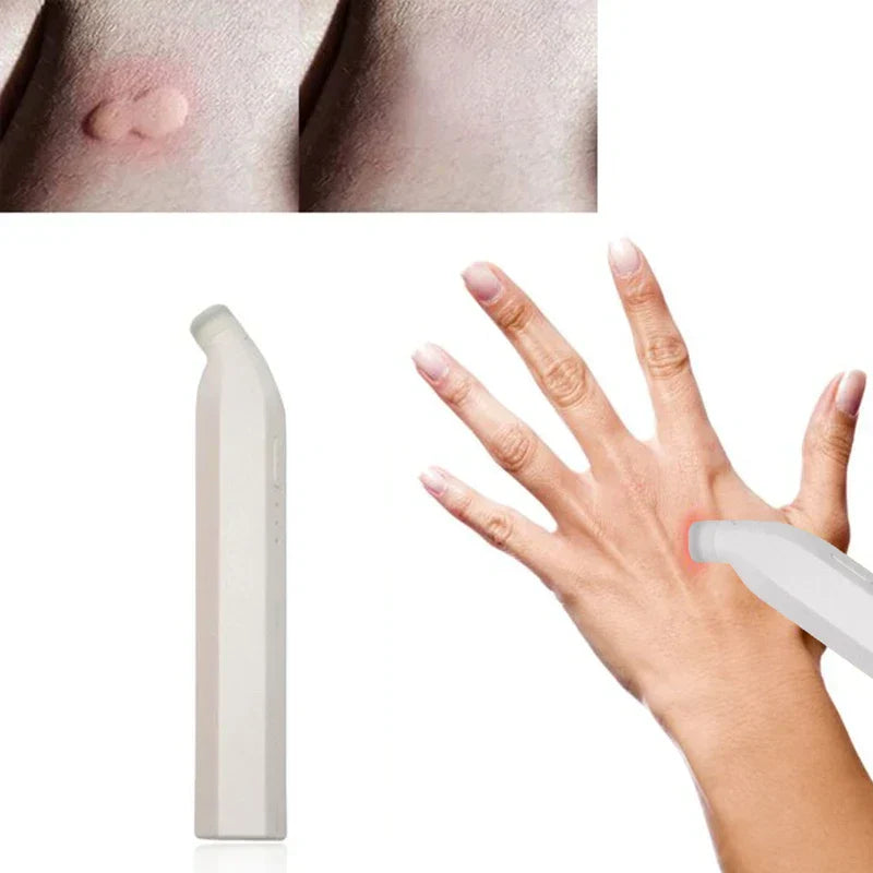 Bug Bite Itch Relief Stick - White handheld pen device beside a hand using the device on the skin, with two close-up skin patch images at the top