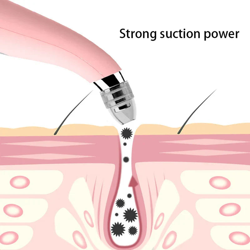 Deep Cleansing Facial Suction Extractor Device