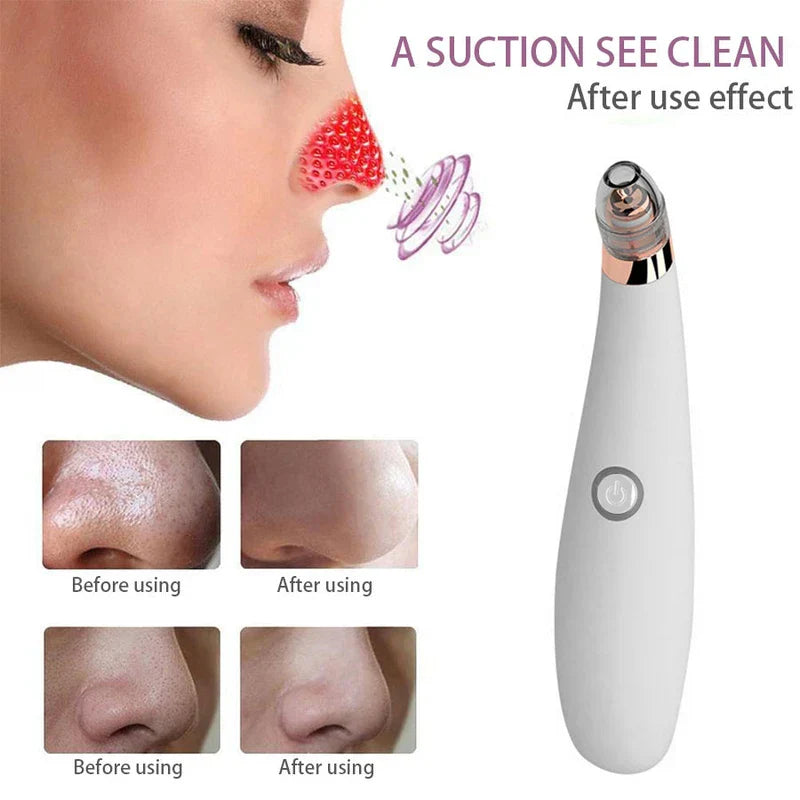 Deep Cleansing Facial Suction Extractor Device