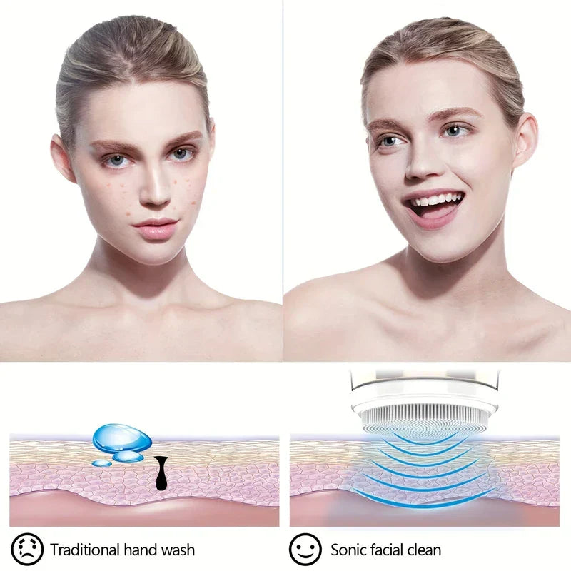 Facial Cleansing Spin Brush - Comparison graphic showing skin blemishes left and clear skin right, with skin cross-section diagrams for hand wash vs sonic cleansing