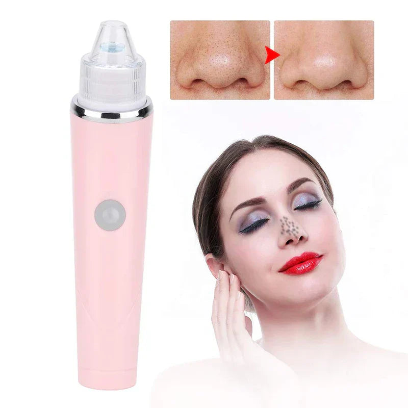 Pore Suction Cleaner - Facial cleansing device shown alongside before/after nose pore comparison and skincare use demonstration