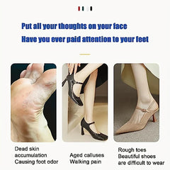 Electric Foot Callus Remover Rechargeable