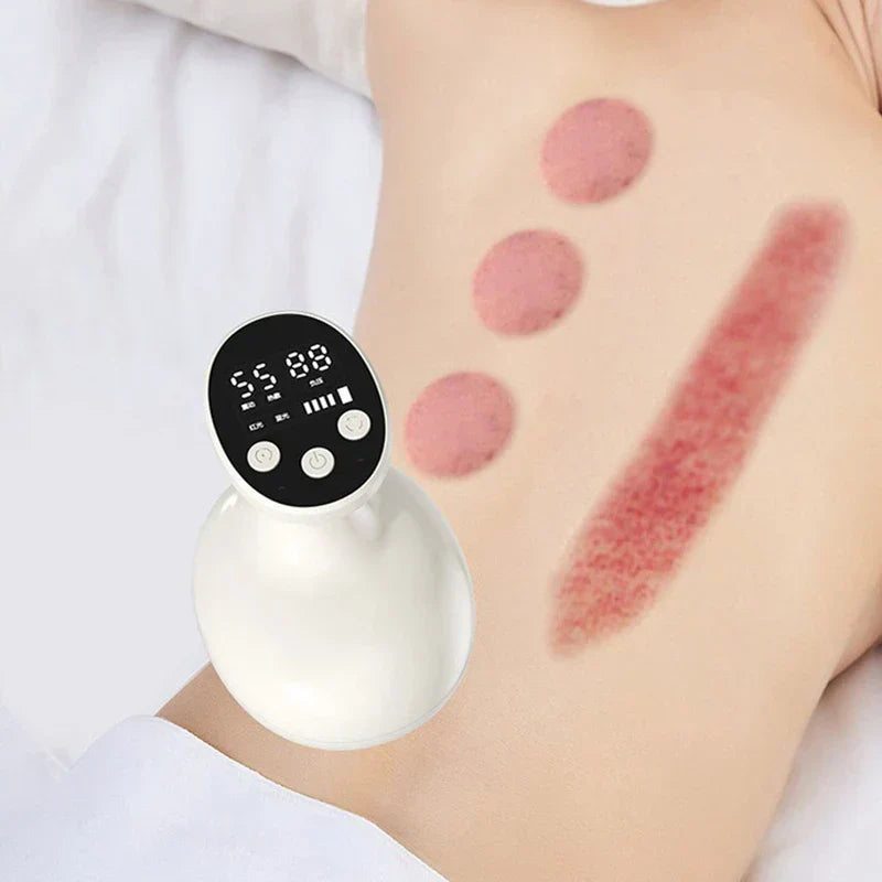 Electric Gua Sha Tool - White handheld electric massager displayed beside a person’s back with round and long red marks