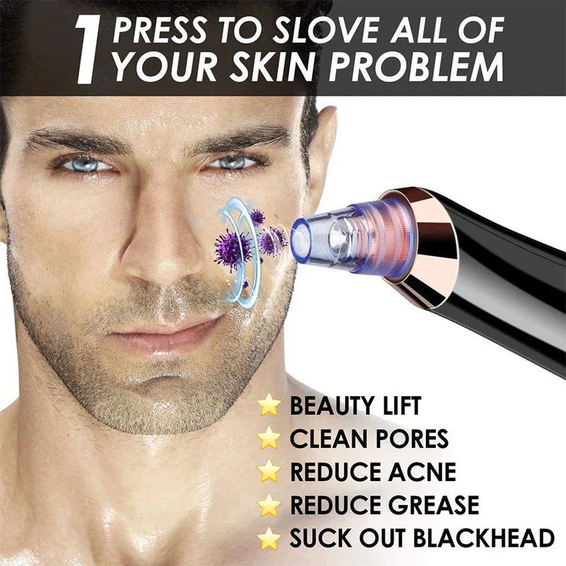 Facial Comedone Extractor Vacuum Device