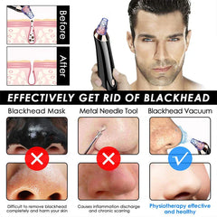 Facial Comedone Extractor Vacuum Device