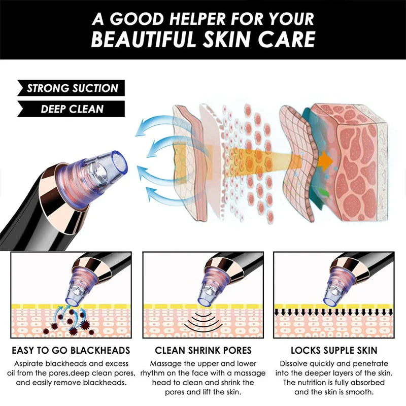 Facial Comedone Extractor Vacuum Device