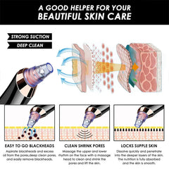 Facial Comedone Extractor Vacuum Device