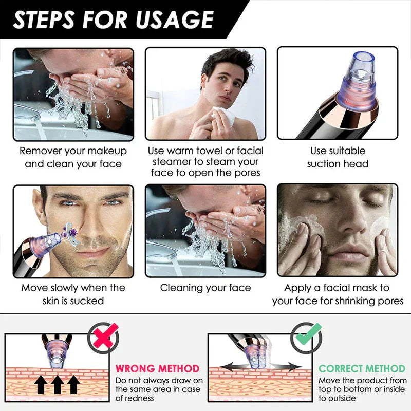 Vacuum Device - Diagram showing six steps for using a blackhead suction device, plus illustrations of correct and incorrect movement technique.