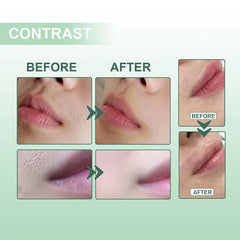 Wax Strips Paper - Before and after comparison grid showing upper lip hair removal results