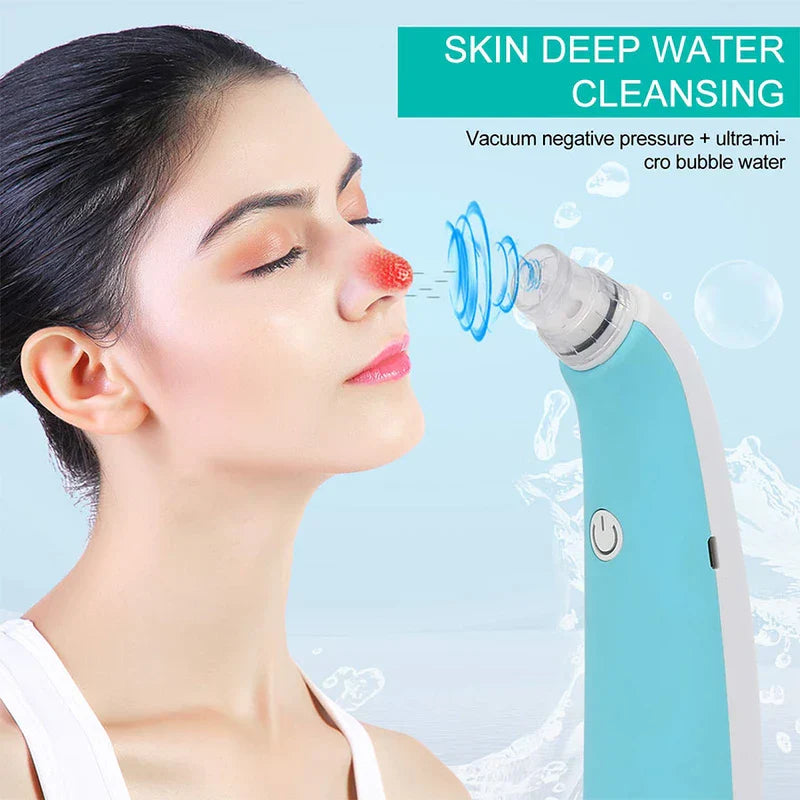 Foaming Vacuum Blackhead Remover Pore Cleaner