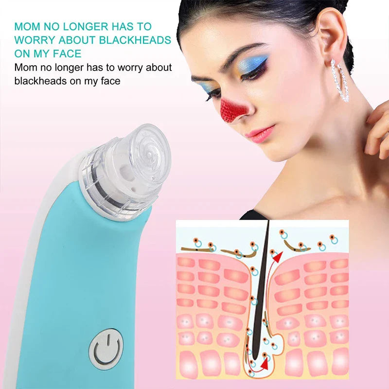 Foaming Vacuum Blackhead Remover Pore Cleaner