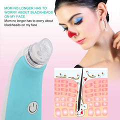 Foaming Vacuum Blackhead Remover Pore Cleaner