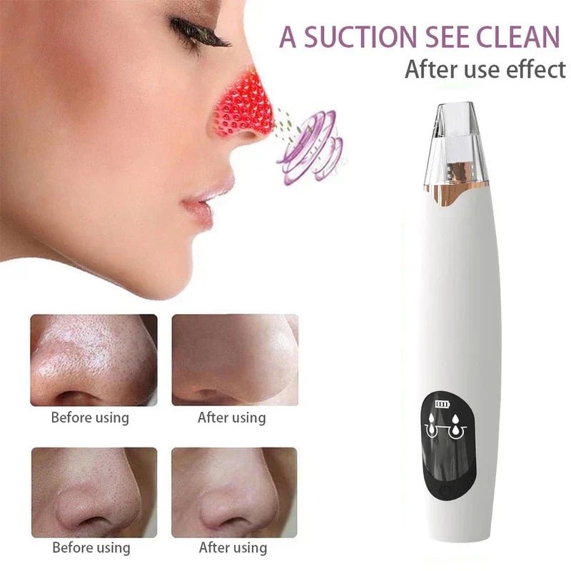 Hot & Cold Compress - Infographic showing before and after pore appearance on nose alongside the suction device