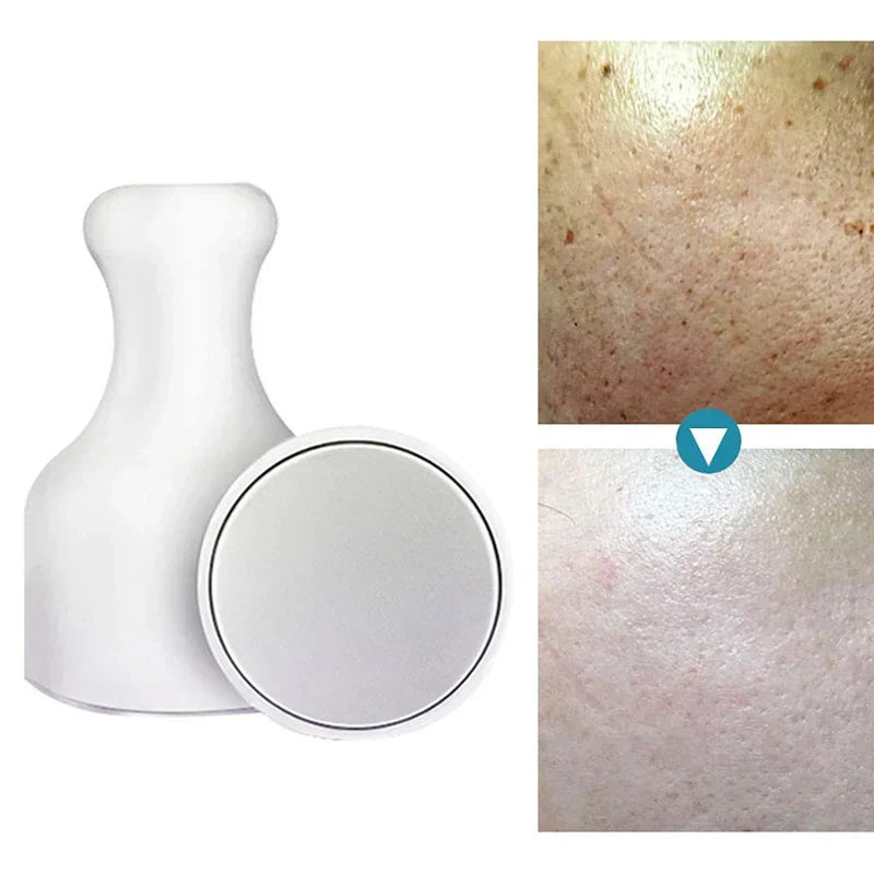 Ice Roller - White handheld beauty tool displayed alongside two close-up skin comparison photos showing before and after skin texture