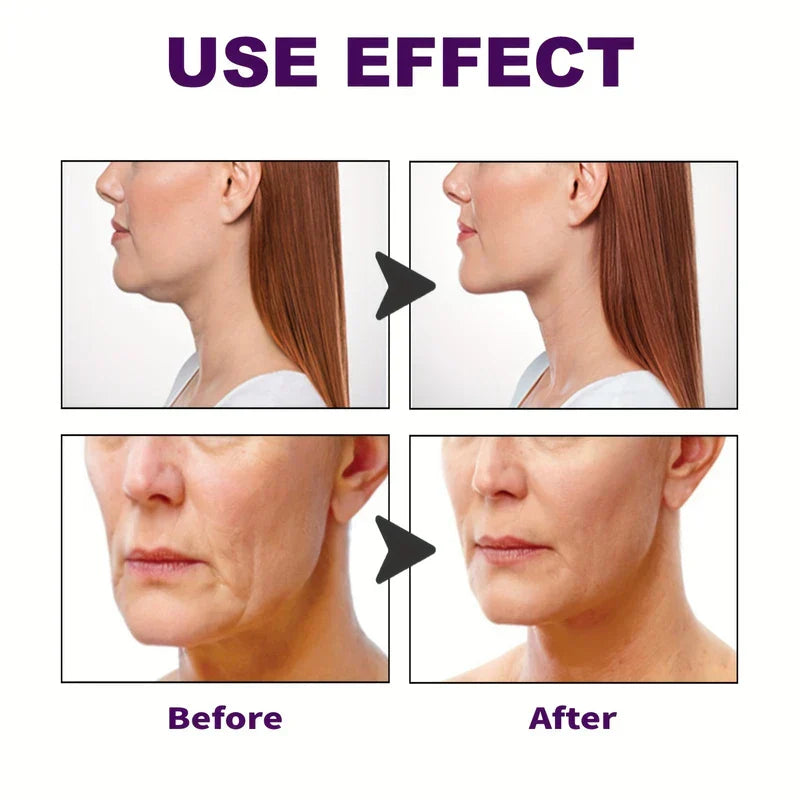Invisible Face Lift Tape Stickers - Side-by-side before and after comparison showing temporary facial lifting results on jawline and lower face
