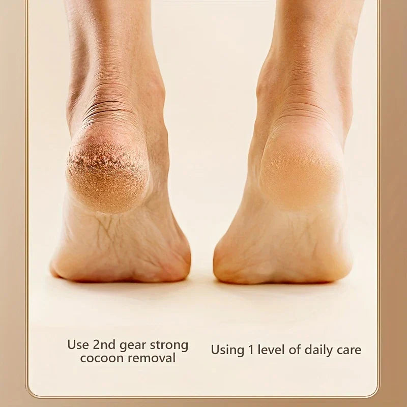 Manual Foot File - Comparison of two human heels: left dry rough textured, right smooth soft skin, with text labeling each.
