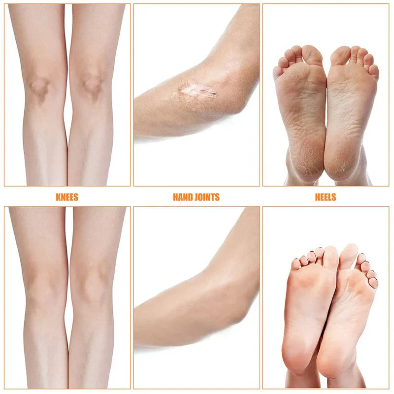 Moon Shape Electric Foot File Callus Remover