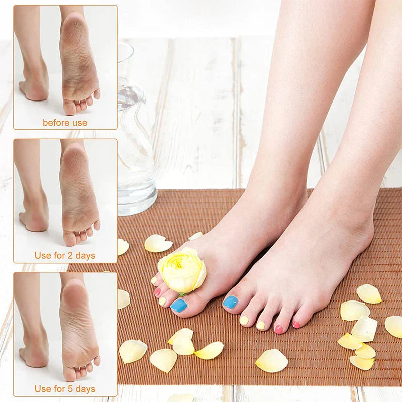 Moon Shape Electric Foot File Callus Remover
