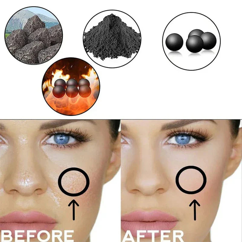 Facial Extraction Tool - Split before-after facial comparison graphic showing textured skin on left, smooth skin on right, with four circular ingredient illustrations above