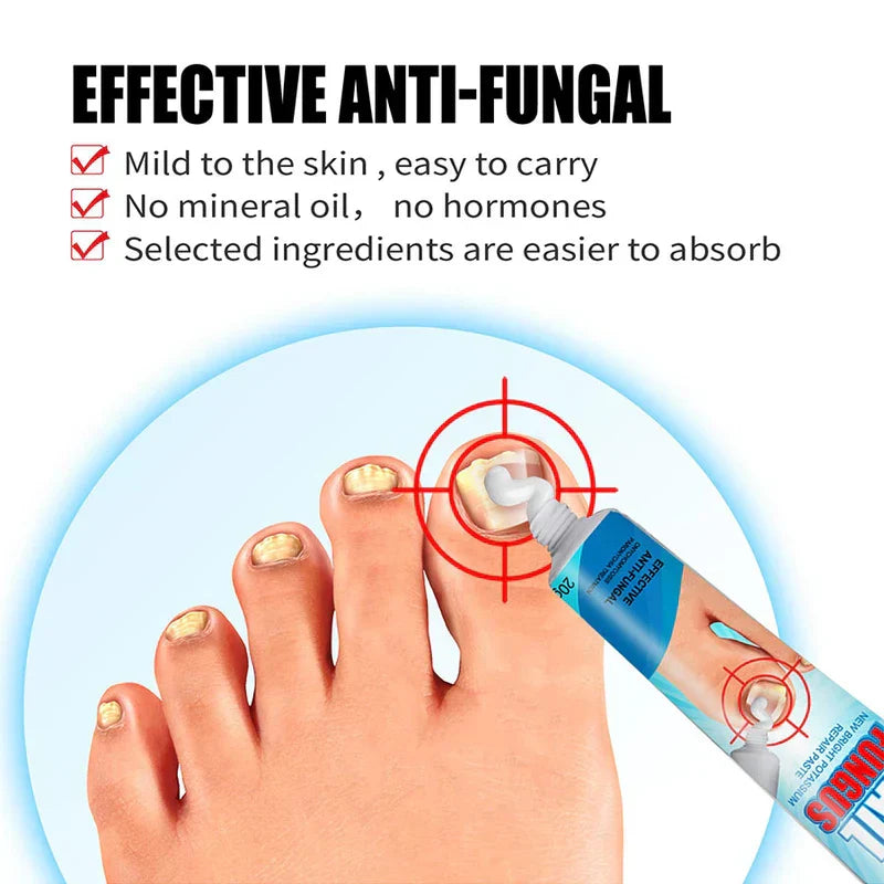Anti fungal cream for nails being applied to a discolored toenail, with three feature bullet points above.