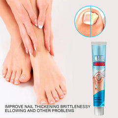 Healthy hands and feet, split comparison of fungal and clear toenail, and tube of anti fungal cream for nails
