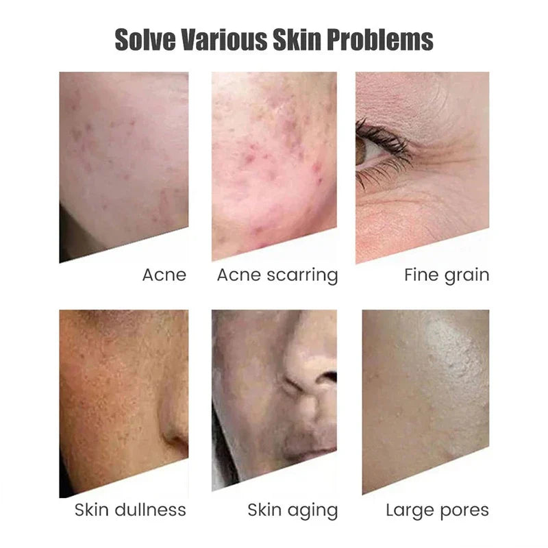 Nano Crystal Needle Free Meso Therapy Injector