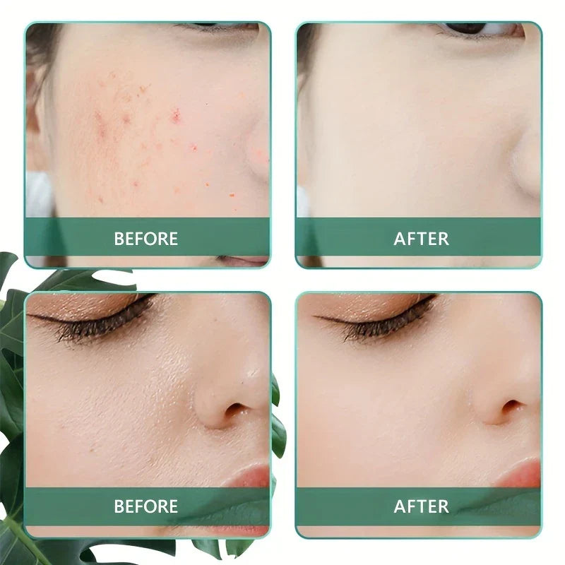 Portable Oxygen Facial Mist Sprayer