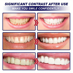 Professional Teeth Whitening Strips