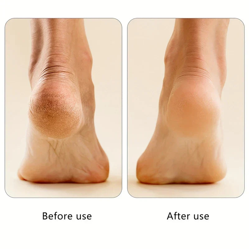 Rechargeable Electric Callus Remover Foot File