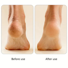 Rechargeable Electric Callus Remover Foot File