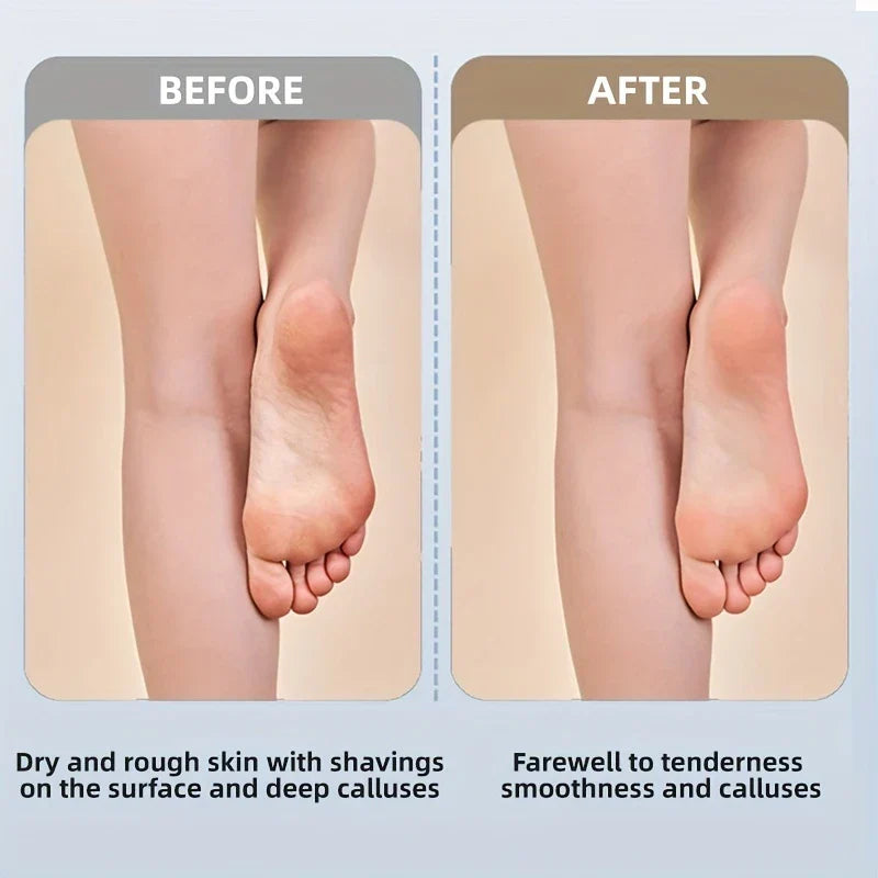 Rechargeable Electric Foot File Callus Remover