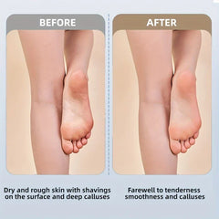 Before and after comparison of feet showing dry callused skin and smooth skin, for electric foot file callus remover