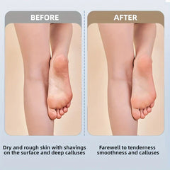 Rechargeable Electric Foot File Callus Remover