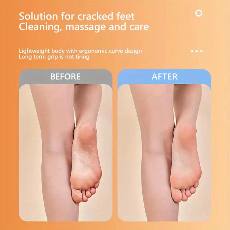 Before and after comparison of feet with text about cracked feet care and elmchee callus remover