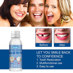 Temporary Tooth Repair Kit Filling Beads