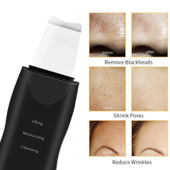 Espátula exfoliadora de piel: espátula exfoliadora ultrasónica negra junto a tres conjuntos de fotos comparativas de antes y después de la piel