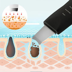 Skin Scrubber Spatula - Diagram showing ultrasonic skin scrubber working on a cross-section of skin, with an inset closeup of ingredient penetration