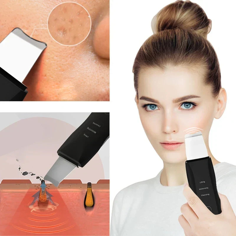 Skin Scrubber Spatula - Collage showing the skin scrubber in use on a person’s face, with two smaller insets of the device on skin and a pore cleansing diagram