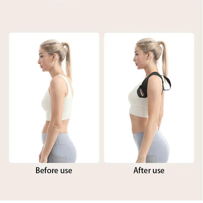 Shoulder Support Belt - Side-by-side side view comparison of a woman, left without a posture corrector, right wearing a black posture corrector, labeled before and after use