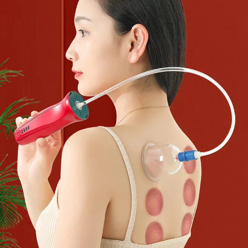 Person using a red electric cupping therapy set with a connected tube and clear cup applied to the back, which has visible cupping marks