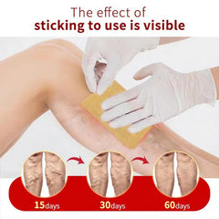 Varicose Vein Support Patches