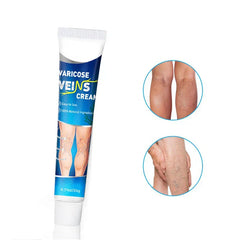 Itch Relief Cream - Cream tube displayed next to circular insets of affected leg areas