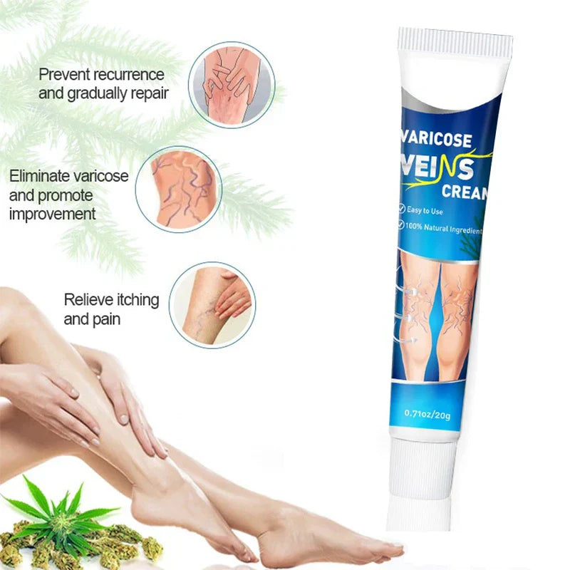 Varicose Vein Treatment Relief Cream