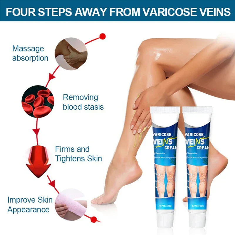 Varicose Vein Treatment Relief Cream