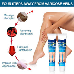 Varicose Vein Treatment Relief Cream